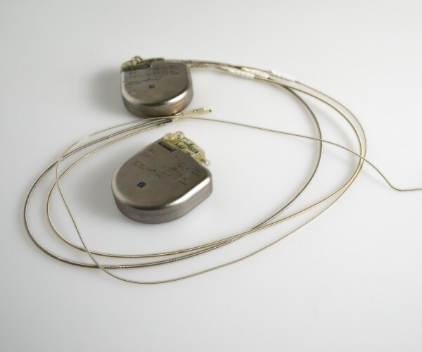 implantable cardioverter defibrillator