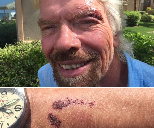 Richard Branson: Stingray Attack Was a Shark Kiss, Technically Speaking