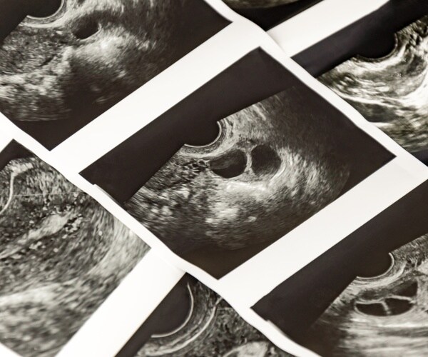 ultrasound images