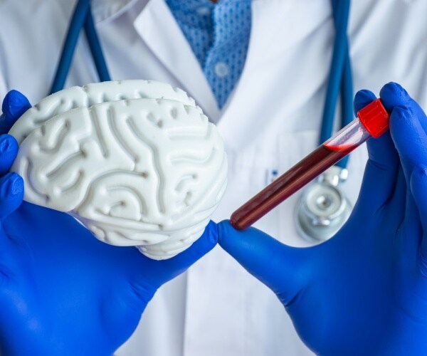 scientist holding a vial of blood next to a model of a brain