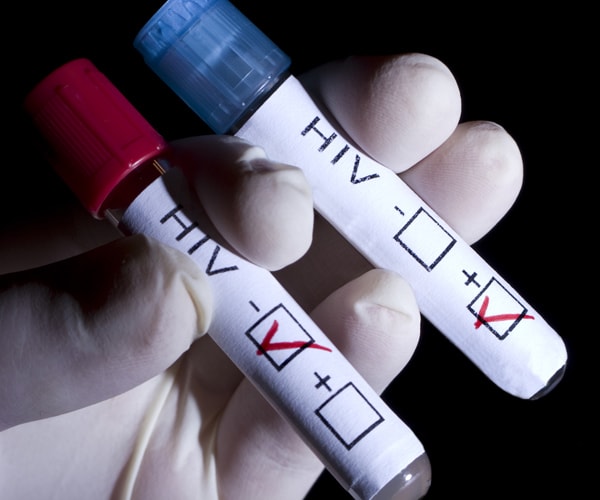 HIV in Remission Without Drugs: South African Child Virus-Free for 8 Years