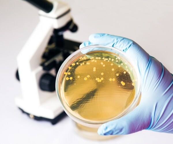 gloved hand holding a petri dish with e.coli in a lab