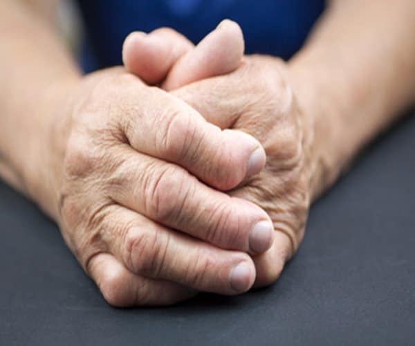 Rheumatoid Arthritis Drug Succeeds in Trial