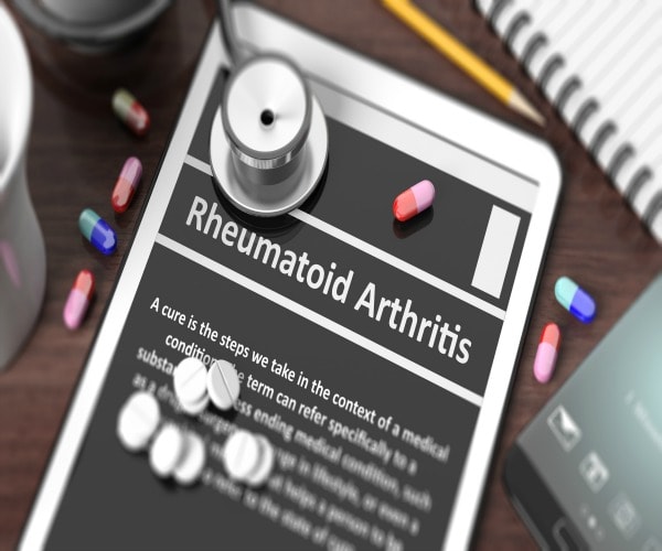 Quitting Smoking Helps Rheumatoid Arthritis 