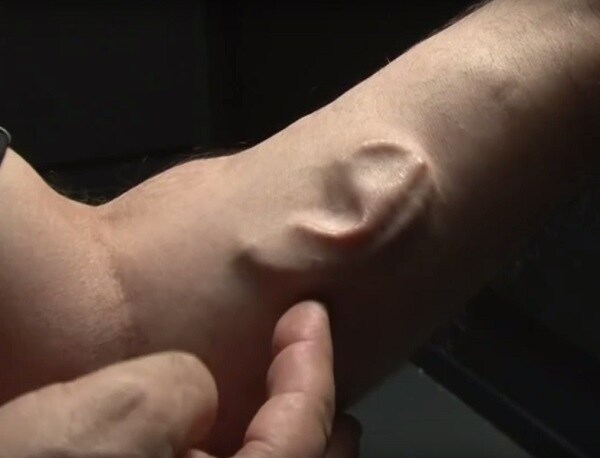 Stelarc's Ear on His Arm Was Grown for Body Performance Art