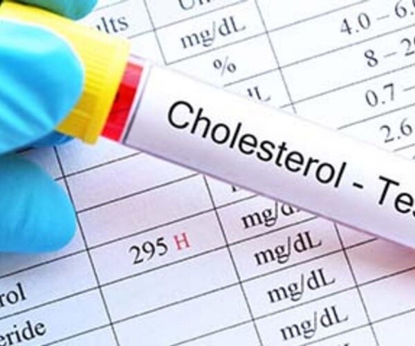 vial of blood for cholesterol test