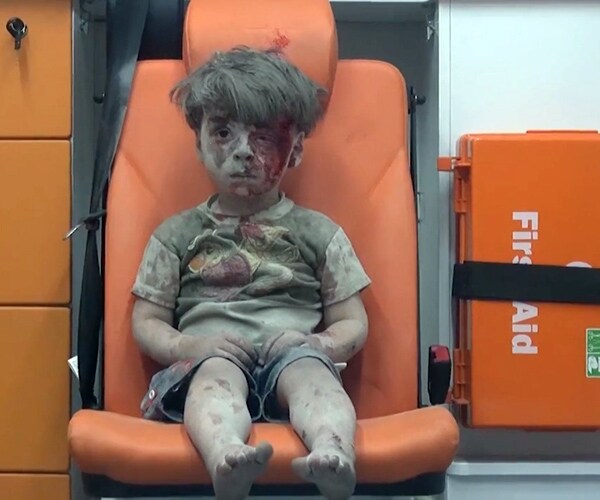 Aleppo Wounded Boy's Image Becomes Poster for Syria Terror