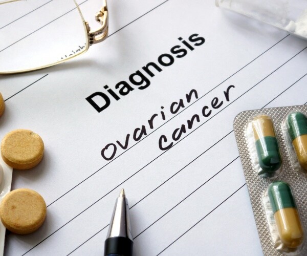 medical chart "diagnosis ovarian cancer"