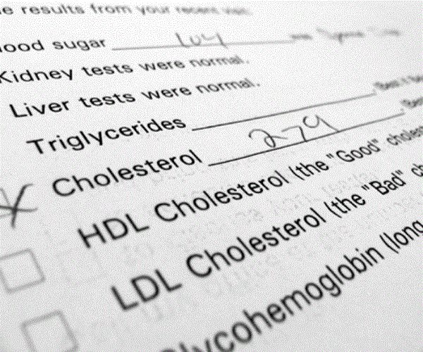 No Association Between 'Bad Cholesterol' and Senior Deaths: Study