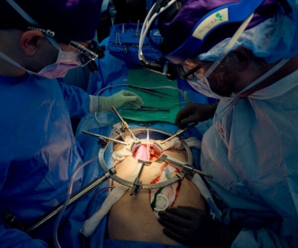 surgeons performing transplant surgery