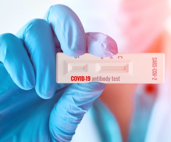 COVID antibody test