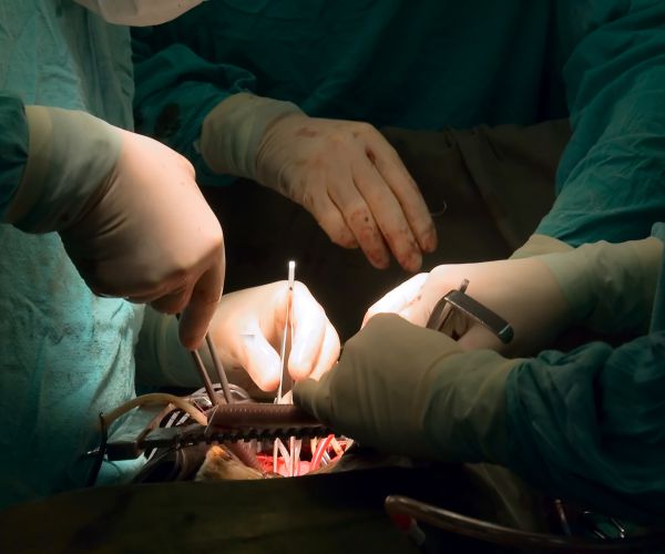 Wrong Patient! Surgeon Removes Kidney