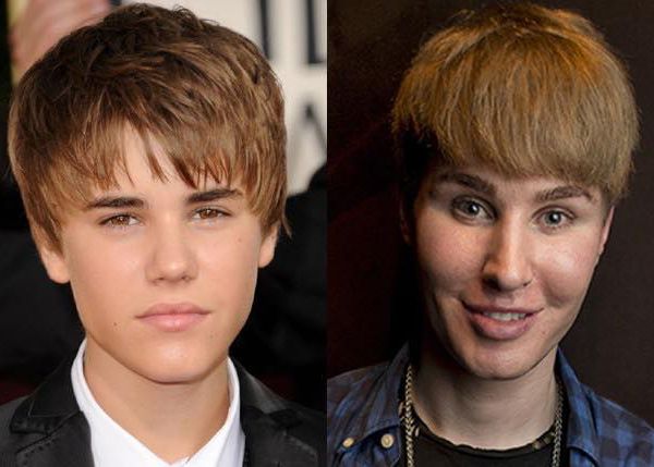 Tobias Strebel, Justin Bieber Wannabe Featured on 'Botched,' Found Dead