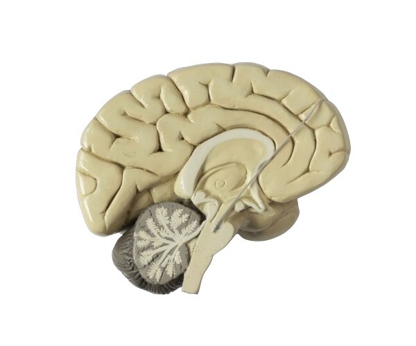 model of a brain with a long pin signifying stimulation