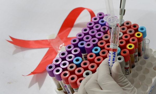 HIV Less Deadly as Virus Evolves, New Study Shows