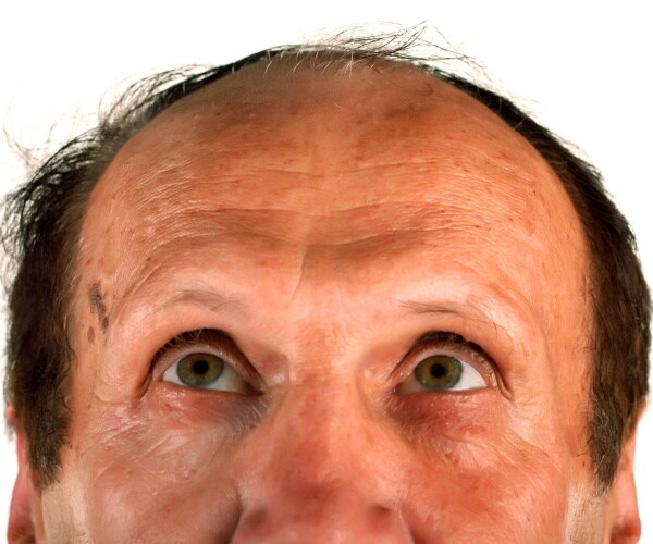 close up of man looking up to his balding head