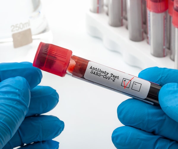 a blood sample for a coronavirus antibody test