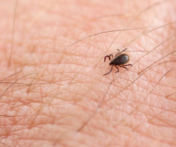 Powassan Virus, Deadly Tick-Borne Illness, Is Spreading