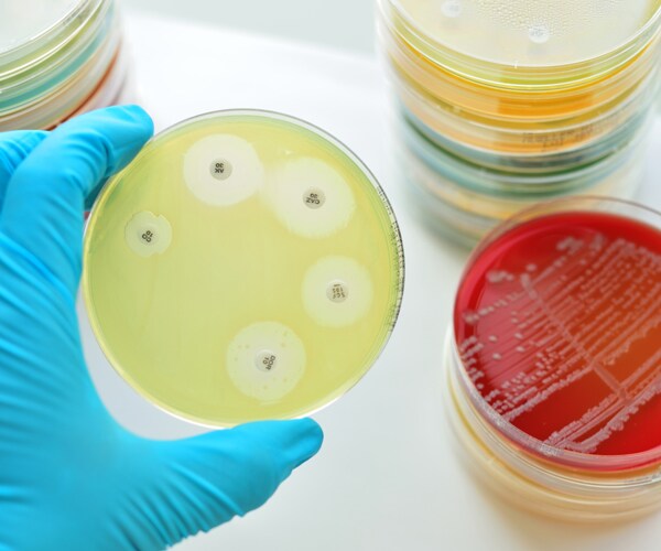 bacteria in a petri dish