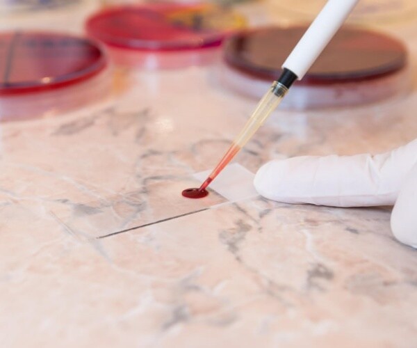 blood being dripped onto paper for testing