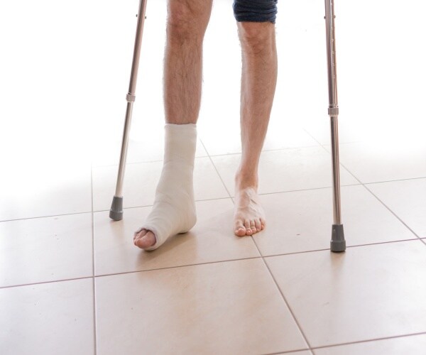 a man on crutches a broken ankle in a cast