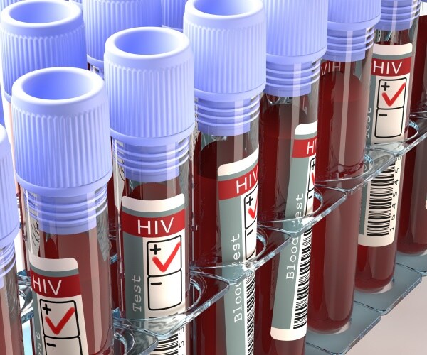 blood samples labeled positive for HIV