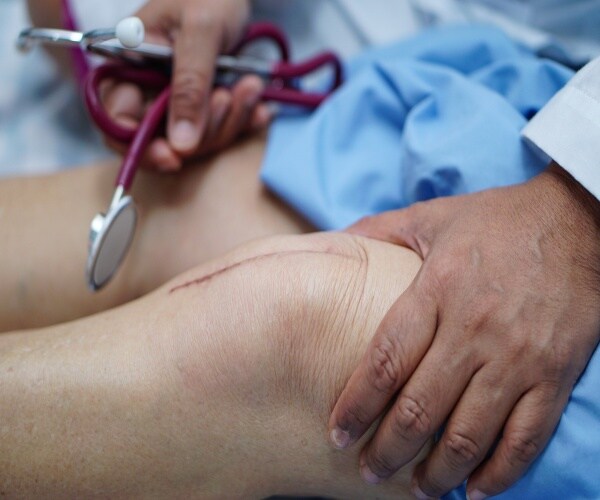 A knee in hospital with knee replacement incision