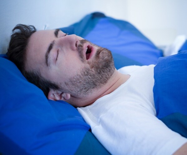 man asleep in bed with mouth open/sleep apnea