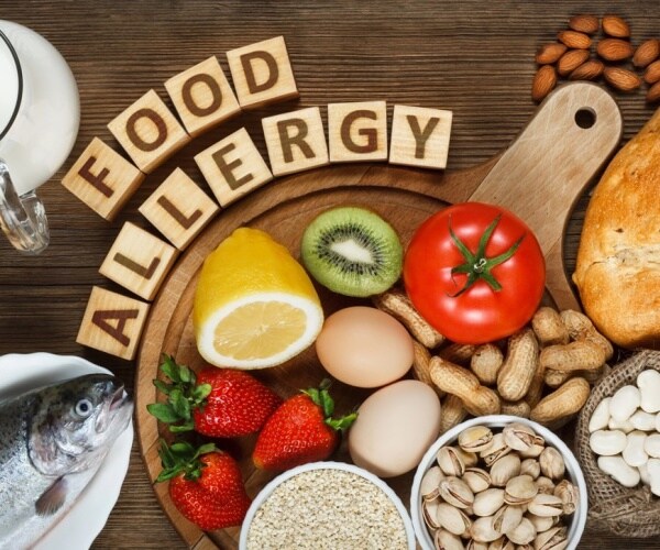 various foods and 'Food Allergy' spelled out in blocks