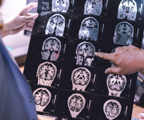 Doctors looking at brain images