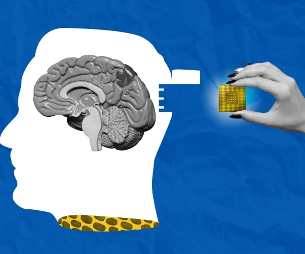 illustration concept of installation of neuralink brain chip