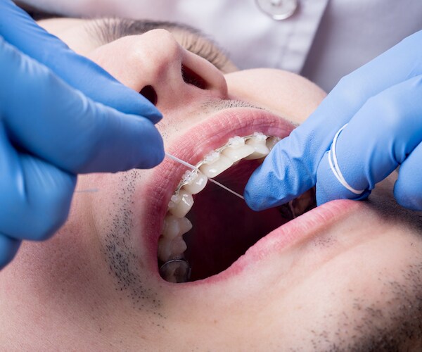 Lung Disease Killing Dentists in Mysterious Cluster: CDC 