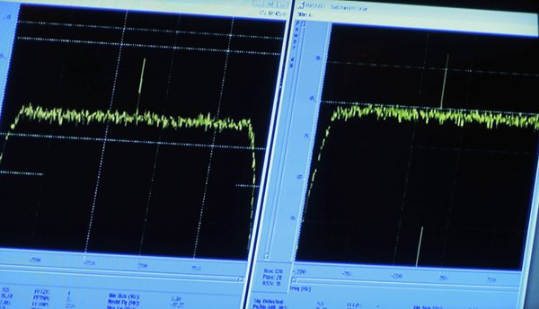 Philae Lander: Dead, or Just Injured on Warmed-Up Comet?