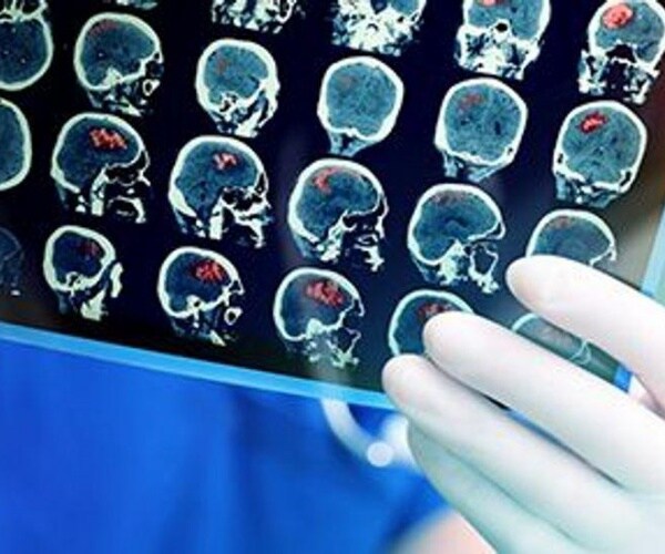 doctor looking at film of brain scans