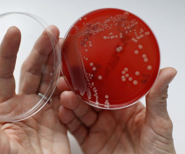 UN Pledges Superbugs Fight as Drug Resistant Bacteria Spread