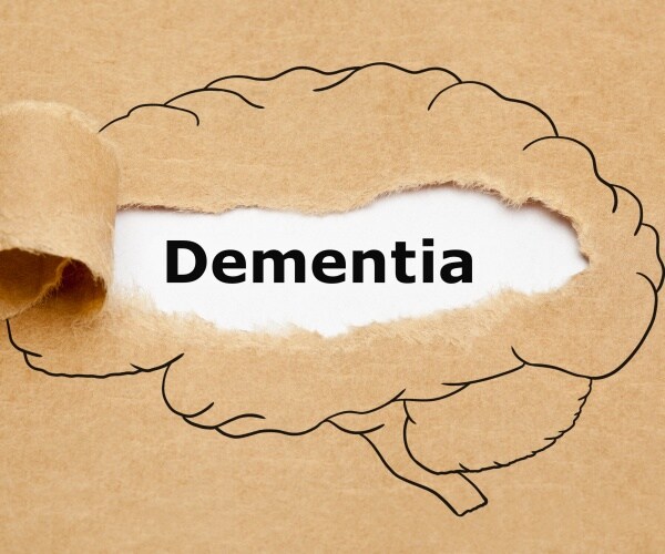 An illustration of a brain on brown paper being pulled back to reveal 'dementia' 