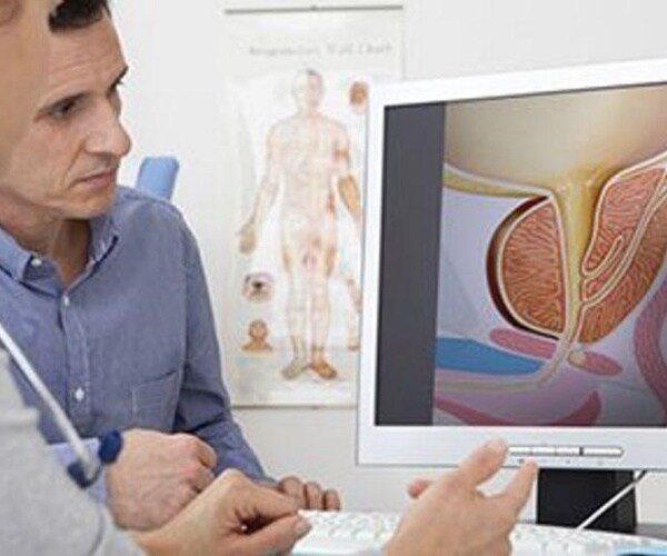 doctor reviewing illustration of prostate gland on computer with patient