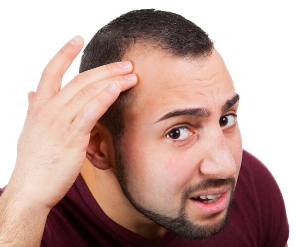 man looking at his balding head in mirror