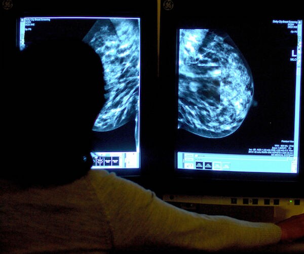 Mammograms: Overdiagnosis a Concern, Danish Study Says