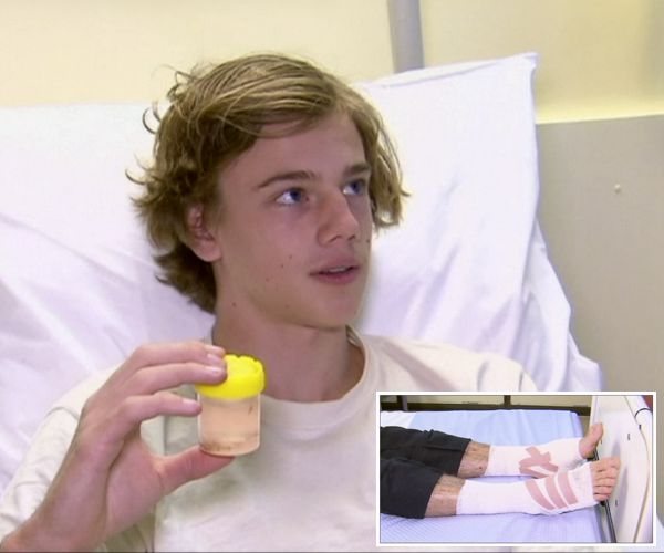 Australian Teen's Sea Lice Encounter Sends Him to Hospital