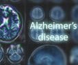 Alzheimer's Agitation Drug Trial Data Mixed