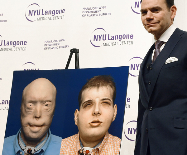 7-w--Face-transplant-GettyImages-497377676.jpg